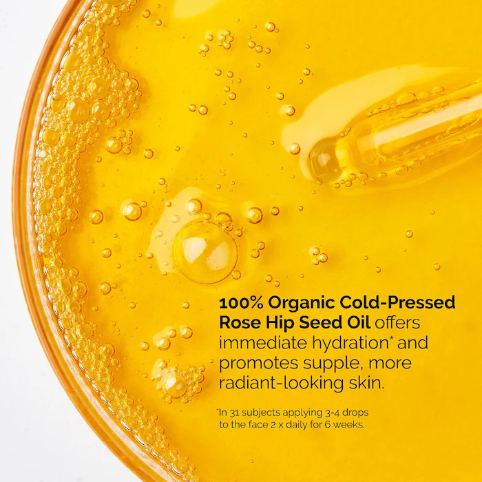 100% biologische koudgeperste  - Cold Pressed Rose Hip recensie en prijs
