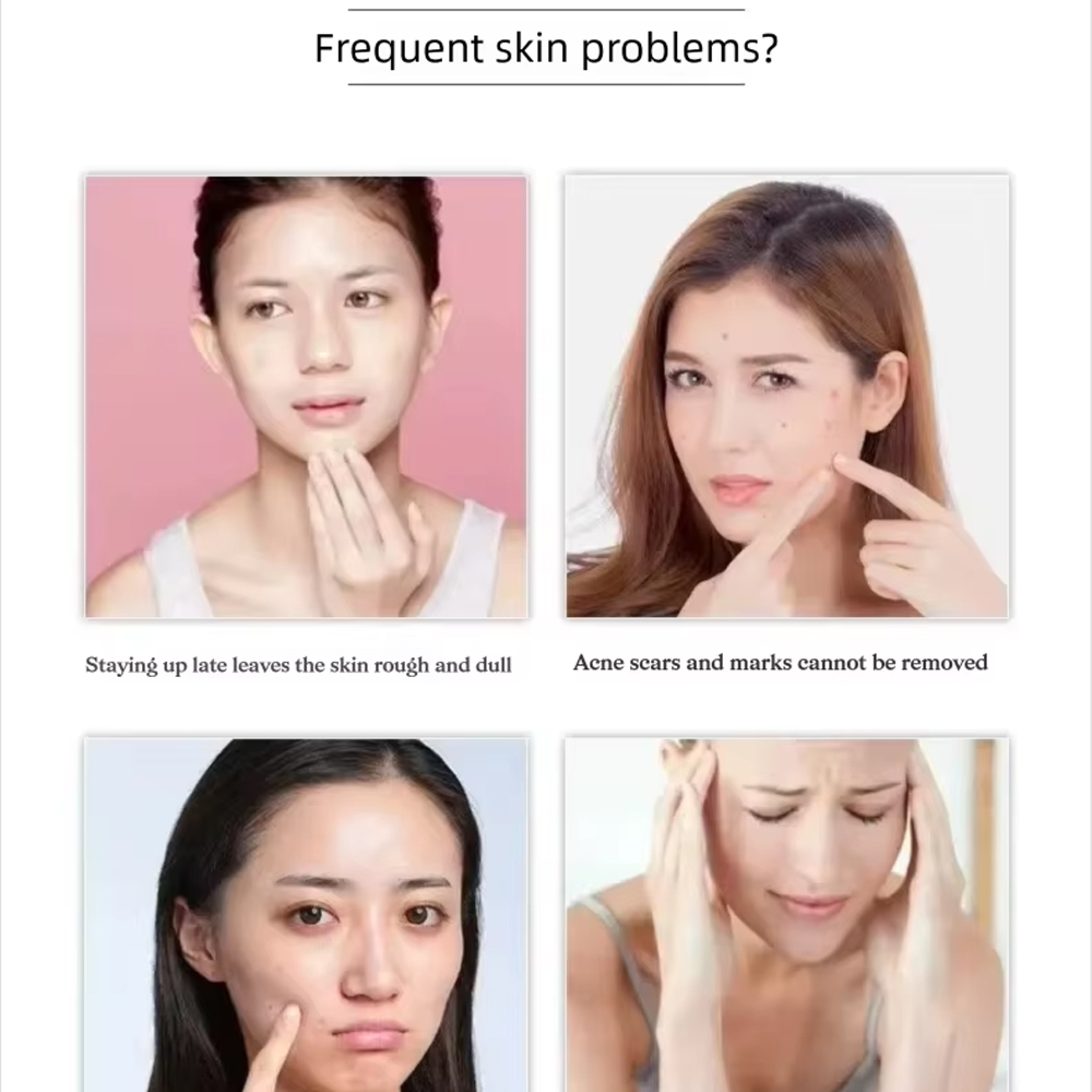 Korea Hoogwaardig 100mg Gefree - Luxury Skincare Brands recensie en prijs